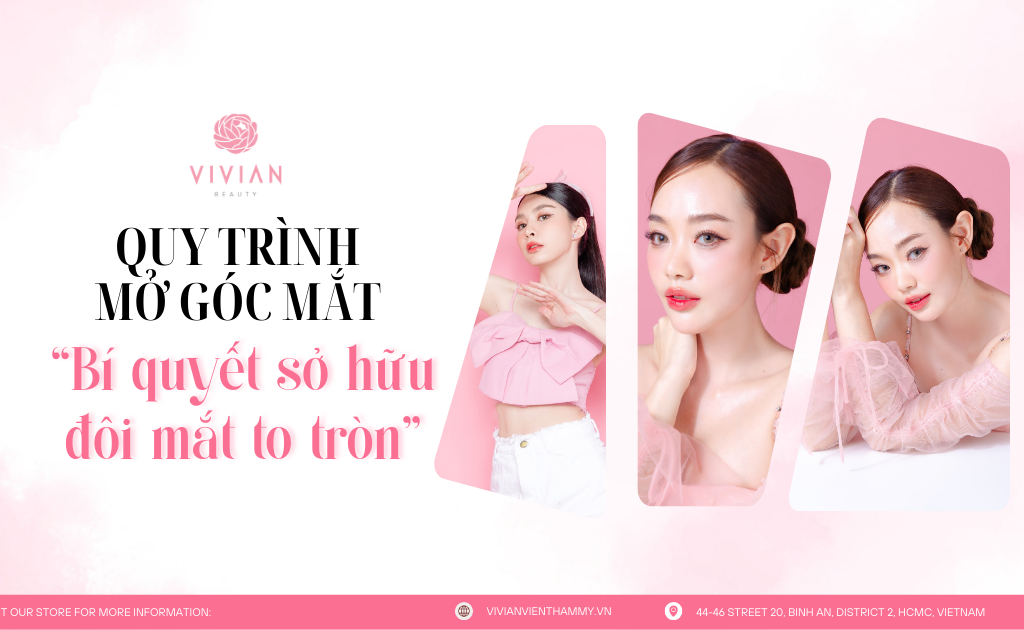 mở góc mắt tại vivian