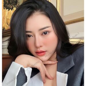 Khách hàng sau khi nâng mũi tại Vivian